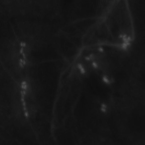 Bacteriophage on a slide